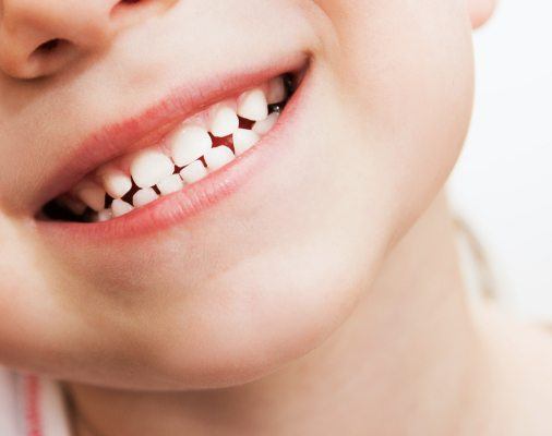 Closeup of child's healthy smile after children's dentistry