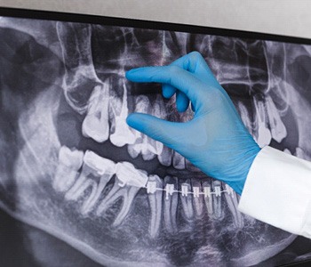 dentist looking at patient x-ray