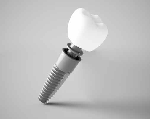 Animated dental implant supported replacement tooth