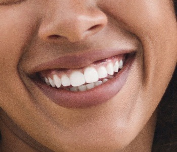 Closeup of smile after dental implant tooth replacement