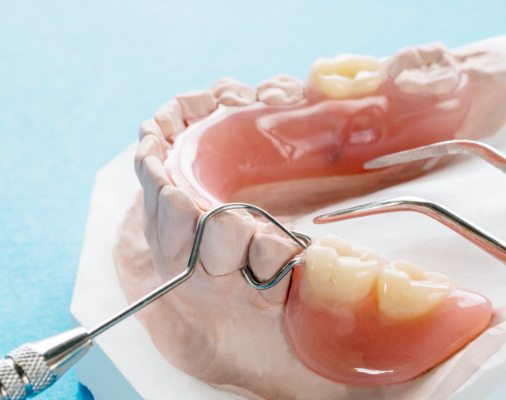 Model smile with partial denture