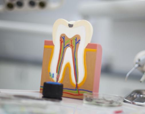 Model of inside of a tooth before root canal therapy