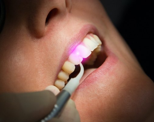 Patient receiving soft tissue laser dentistry treatment