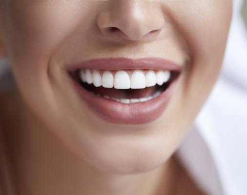 Closeup of flawless smile after porcelain veneer treatment