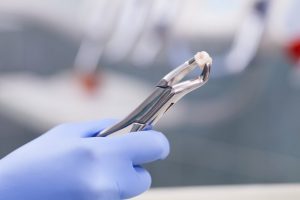 A dentist holding a tooth.