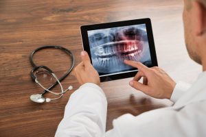 dentist examining digital x-ray