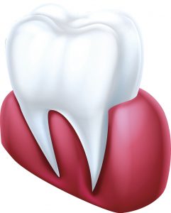 tooth gum line diagram