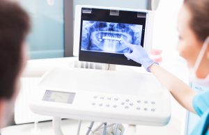 Digital dental x-rays render sharp clear images quickly with scant radiation exposure. The team at Mt. Holly Family Dentistry explains their uses.