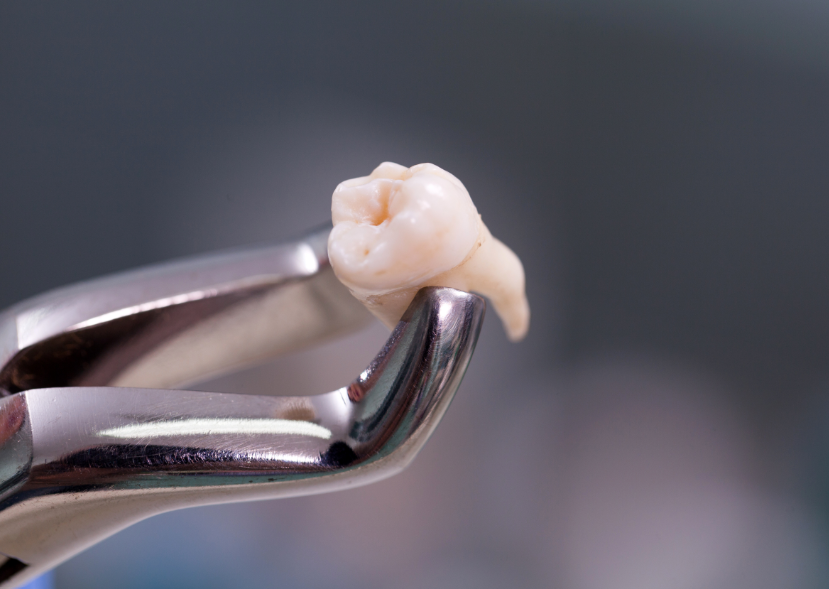 Tooth on forceps